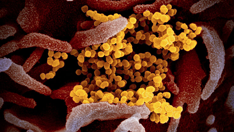 Tin mừng cho nhân loại trong trận chiến chống coronavirus đang loé lên từ California